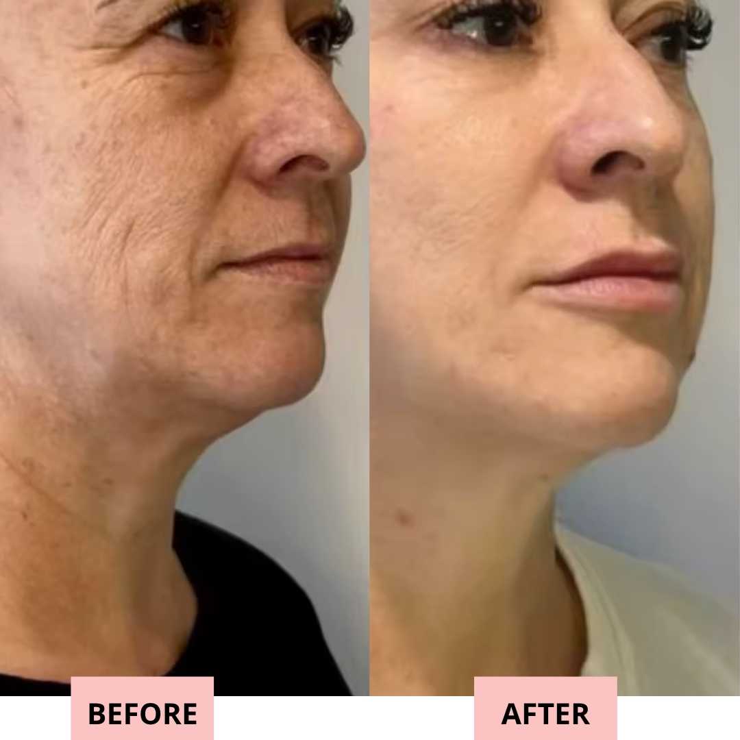 Drevelo 7-in-1 LED Facial Sculptor