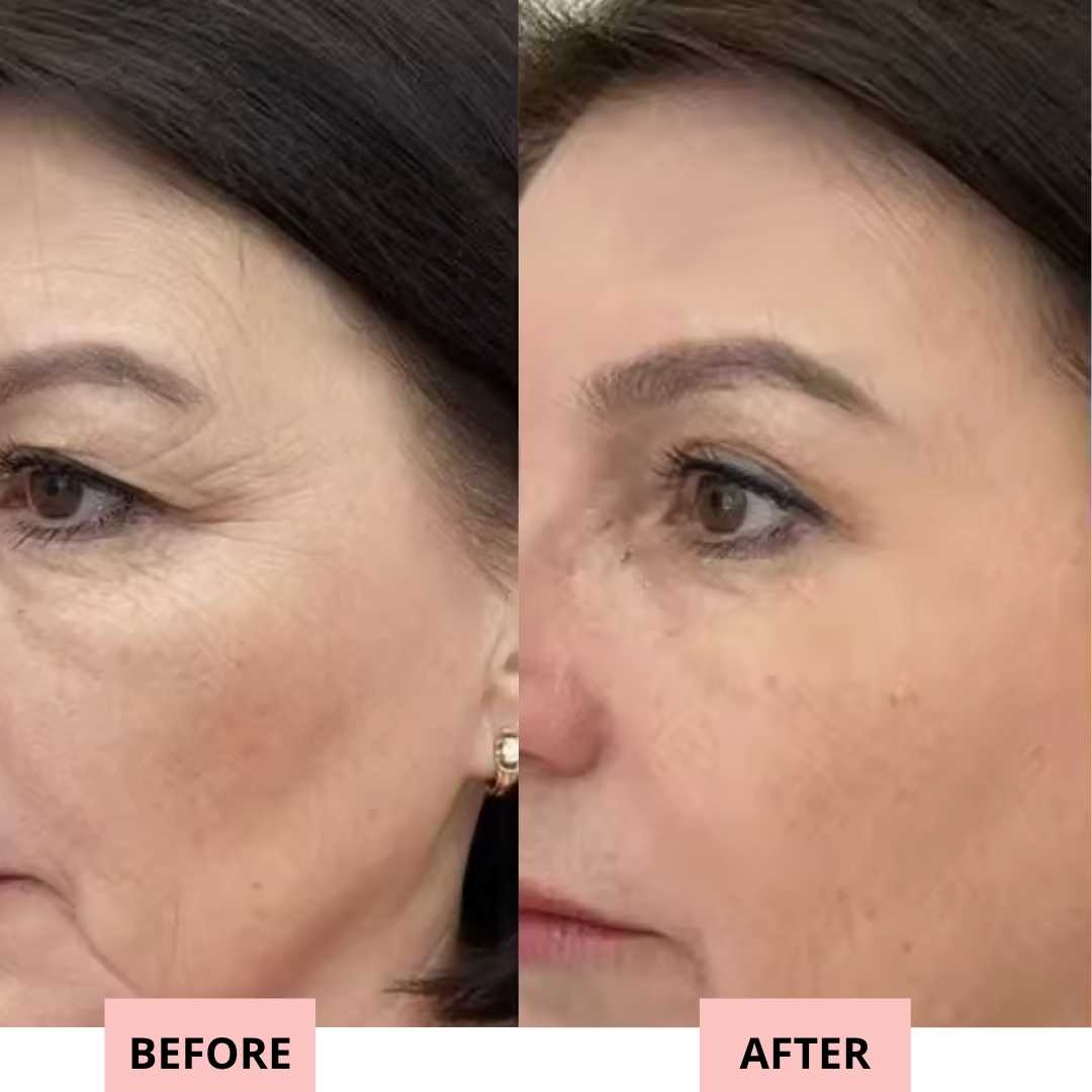 Drevelo 7-in-1 LED Facial Sculptor