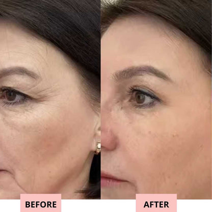 Drevelo 7-in-1 LED Facial Sculptor