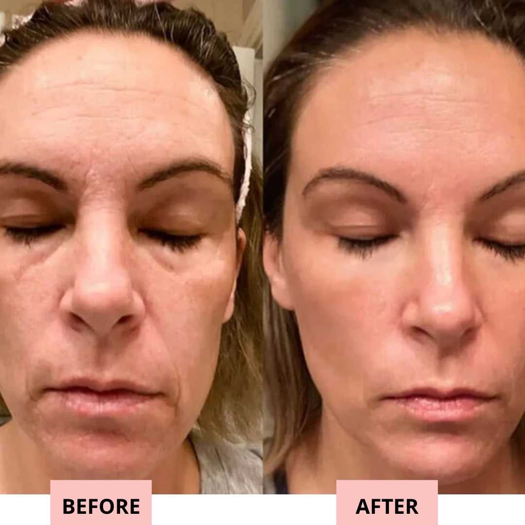 Drevelo 7-in-1 LED Facial Sculptor