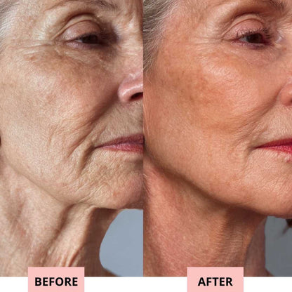 Drevelo 7-in-1 LED Facial Sculptor