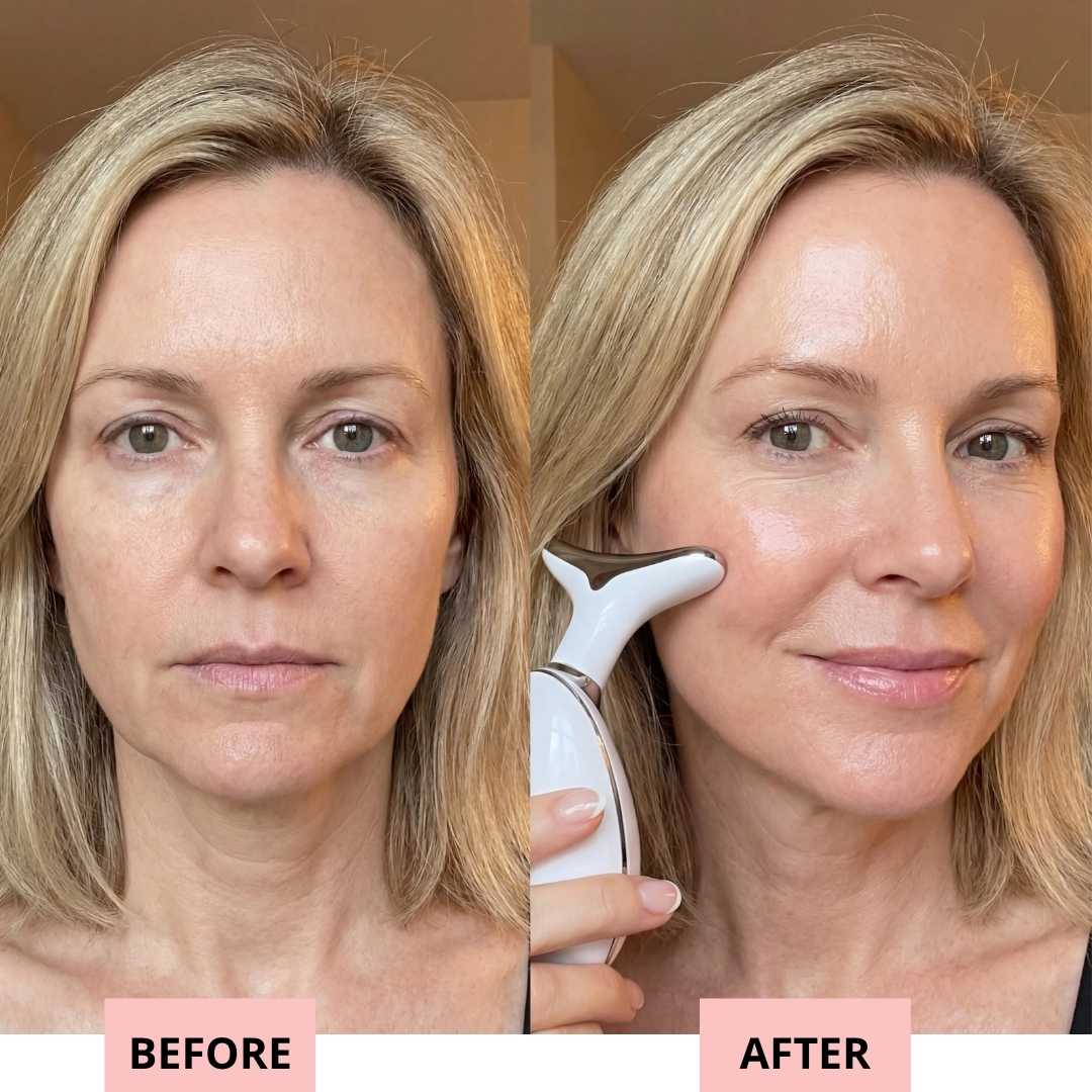 Drevelo 7-in-1 LED Facial Sculptor